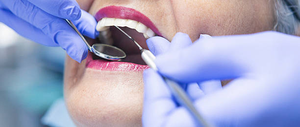 Best Emergency Tooth Extraction in Trenton, OH